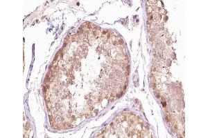 ABIN6266666 at 1/100 staining human testis tissue sections by IHC-P. (TUBG1 anticorps  (N-Term))
