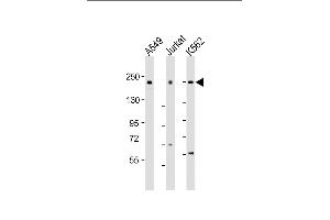 All lanes : Anti-PSME4 Antibody (N-Term) at 1:2000 dilution Lane 1: A549 whole cell lysate Lane 2: Jurkat whole cell lysate Lane 3: K562 whole cell lysate Lysates/proteins at 20 μg per lane. (PSME4 anticorps  (AA 503-535))