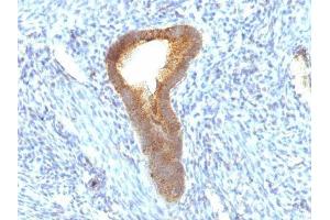 Image no. 1 for anti-Alkaline Phosphatase (ALP) antibody (ABIN6155884) (Alkaline Phosphatase anticorps)