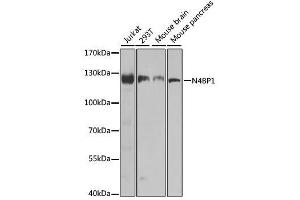 Western blot analysis of extracts of various cell lines, using N4BP1 antibody. (N4BP1 anticorps  (AA 190-590))