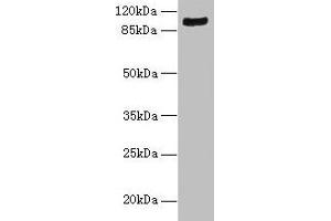 Western blot All lanes: TMTC1 antibody at 6 μg/mL + Mouse large intestine tissue Secondary Goat polyclonal to rabbit IgG at 1/10000 dilution Predicted band size: 99, 88, 74, 66, 26 kDa Observed band size: 99 kDa (TMTC1 anticorps  (AA 1-227))