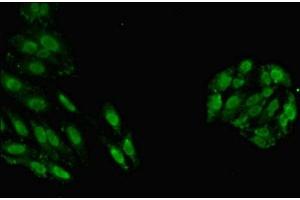 Immunofluorescent analysis of HepG2 cells using ABIN7154122 at dilution of 1:100 and Alexa Fluor 488-congugated AffiniPure Goat Anti-Rabbit IgG(H+L) (GSTT1 anticorps  (AA 2-240))