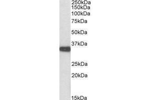 AP23666PU-N ASPA antibody staining of Mouse Kidney lysate at 0. (ASPA anticorps  (C-Term))