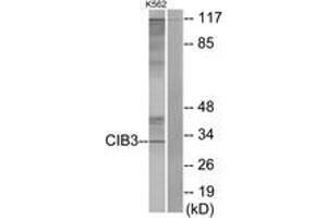Western blot analysis of extracts from K562 cells, using CIB3 Antibody. (CIB3 anticorps  (AA 138-187))