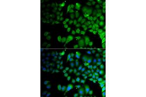 Immunofluorescence analysis of A549 cell using JMJD7 antibody. (JMJD7 anticorps)