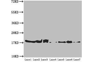Western blot All lanes: ATP5H antibody at 5. (ATP5H anticorps  (AA 1-161))