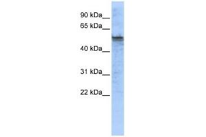 TPH2 antibody used at 1 ug/ml to detect target protein. (Tryptophan Hydroxylase 2 anticorps  (Middle Region))