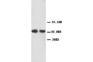 Anti-CXCR2 antibody, Western blotting Lane 1: Human Rectal Cancer Tissue Lysate Lane 2: Human Rectal Cancer Tissue Lysate (CXCR2 anticorps  (Middle Region))