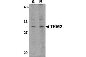 Western Blotting (WB) image for anti-RASD Family, Member 2 (RASD2) (C-Term) antibody (ABIN1030728)