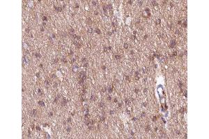 ABIN6266547 at 1/200 staining human brain tissue sections by IHC-P. (mGluR2/3 anticorps)