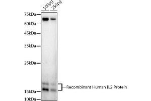 Western blot analysis of extracts of Recombinant Human IL2 Protein, using IL2 antibody (ABIN3020908, ABIN3020909, ABIN3020910 and ABIN6213790) at 1:1000 dilution. (IL-2 anticorps  (AA 21-153))