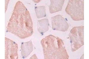 Detection of ENG in Rat Skeletal muscle Tissue using Polyclonal Antibody to Endoglin (ENG)