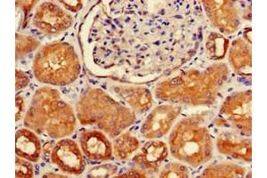 Immunohistochemistry of paraffin-embedded human kidney tissue using ABIN7155721 at dilution of 1:100 (HOXA5 anticorps  (AA 1-270))