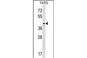 ADHC Antibody (C-term) (ABIN1536884 and ABIN2849555) western blot analysis in T47D cell line lysates (35 μg/lane). (MMADHC anticorps  (C-Term))
