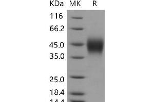 Western Blotting (WB) image for Interferon gamma Receptor 1 (IFNGR1) (Active) protein (His tag) (ABIN7196273)