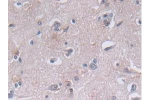 Detection of PGK1 in Human Cerebrum Tissue using Polyclonal Antibody to Phosphoglycerate Kinase 1 (PGK1)