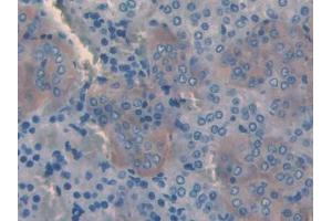 IHC-P analysis of Rat Adrenal gland Tissue, with DAB staining. (SLIT3 anticorps  (AA 62-119))