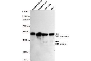 Western blot detection of DR5 in Mouse kindey,Mouse brain,HC and Hela cell lysates using DR5 mouse mAb (1:500-1:2000 diluted).