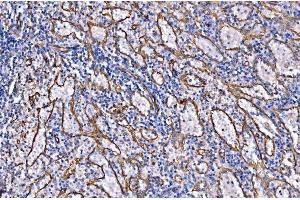 IHC analysis of NLRP7 using anti-NLRP7 antibody (ABIN7599027).