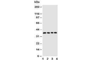 Western blot testing of CD1d antibody and Lane 1:  COLO320 (CD1d anticorps  (AA 76-92))