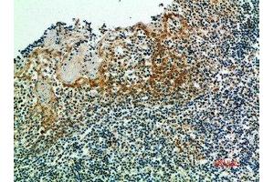 Immunohistochemical analysis of paraffin-embedded human-tonsils, antibody was diluted at 1:200 (IRF3 anticorps  (AA 1268-1341))