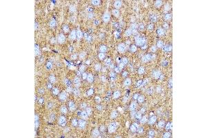 Immunohistochemistry of paraffin-embedded mouse brain using SN Rabbit pAb (ABIN3021231, ABIN3021232, ABIN3021233 and ABIN6214078) at dilution of 1:100 (40x lens). (SNAP25 anticorps  (AA 1-206))