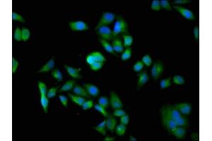 Immunofluorescence staining of Hela cells with ABIN7150124 at 1:100, counter-stained with DAPI. (DDB1 anticorps  (AA 741-943))