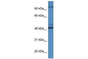 Western Blot showing ATCAY antibody used at a concentration of 1 ug/ml against ACHN Cell Lysate (ATCAY anticorps  (C-Term))