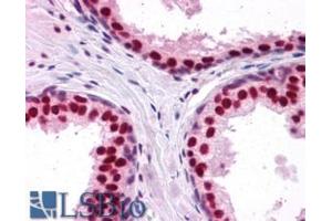 ABIN185199 (2. (DDX5 anticorps  (C-Term))