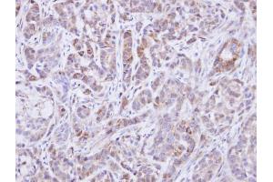 IHC-P Image Immunohistochemical analysis of paraffin-embedded A549 xenograft , using SHP2, antibody at 1:500 dilution.