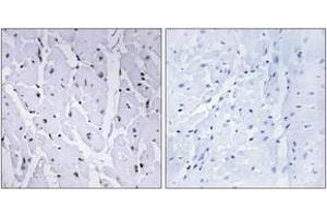 Immunohistochemistry analysis of paraffin-embedded human heart, using MYB (Phospho-Ser12) Antibody.