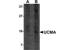 Western blot analysis of UCMA in SW1353 cell lysate with this product at (A) 2. (UCMA anticorps  (C-Term))
