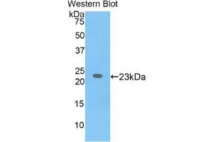 Western blot analysis of the recombinant protein. (IL17 Receptor B anticorps  (AA 310-499))