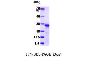 SDS-PAGE (SDS) image for Myosin Regulatory Light Polypeptide 9 (MYL9) (AA 1-172) protein (His tag) (ABIN667358)