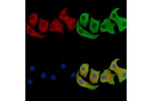 ABIN7096241 and ABIN7100303 staining Hela cells by IF/ICC. (SAMD3 anticorps)