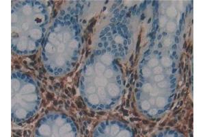 Detection of GAL1 in Human Rectum Tissue using Polyclonal Antibody to Galectin 1 (GAL1)