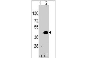 Western blot analysis of WIF1 (arrow) using WIF1 polyclonal antibody . (WIF1 anticorps  (AA 350-379))