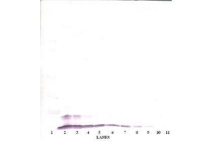 Image no. 1 for anti-Chemokine (C-C Motif) Ligand 4 (CCL4) antibody (ABIN465381) (CCL4 anticorps)