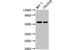 Western Blot Positive WB detected in: MCF-7 whole cell lysate, Colo320 whole cell lysate All lanes: MYOC antibody at 5. (MYOC anticorps  (AA 183-294))