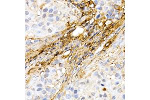 Immunohistochemistry of paraffin-embedded human colon using ASC/TMS1 Rabbit pAb (ABIN6131200, ABIN6146515, ABIN6146516 and ABIN6215212) at dilution of 1:150 (40x lens). (PYCARD anticorps  (AA 50-195))