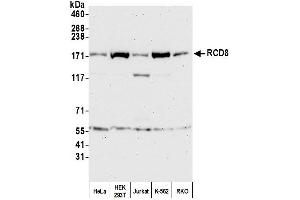 Western Blotting (WB) image for anti-Enhancer of mRNA Decapping 4 (EDC4) (AA 1-50) antibody (ABIN7450645) (EDC4 anticorps  (AA 1-50))