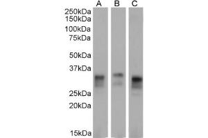 Western Blot using anti-major Prion protein antibody 3F4. (Recombinant PRNP anticorps)