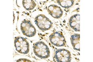 Immunohistochemistry of paraffin embedded human colon using ANXA3 (ABIN7073065) at dilution of 1: 200 (400x lens)