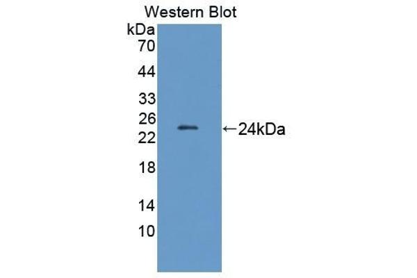 LAMB2 Antikörper  (AA 939-1129)