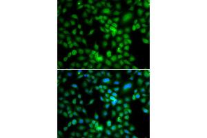 Immunofluorescence analysis of MCF7 cell using SYCE1 antibody. (SYCE1 anticorps)