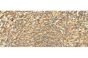 Immunohistochemistry of paraffin-embedded Human tonsil tissue using ABHD10 Polyclonal Antibody at dilution of 1:50(x200)