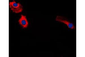 anti-Gastrin (GAST) (Center) antibody