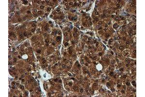 Image no. 11 for anti-Proteasome (Prosome, Macropain) Subunit, beta Type, 9 (Large Multifunctional Peptidase 2) (PSMB9) (AA 21-219) antibody (ABIN1491194)