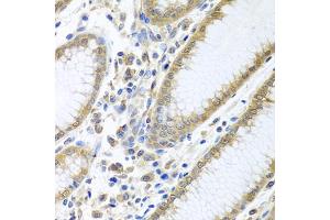 Immunohistochemistry of paraffin-embedded human stomach using EIF4E antibody. (EIF4E anticorps)