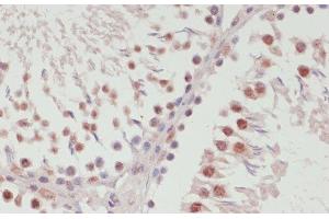 Immunohistochemistry of paraffin-embedded Rat testis using SNRNP70 Polyclonal Antibody at dilution of 1:100 (40x lens). (SNRNP70 anticorps)